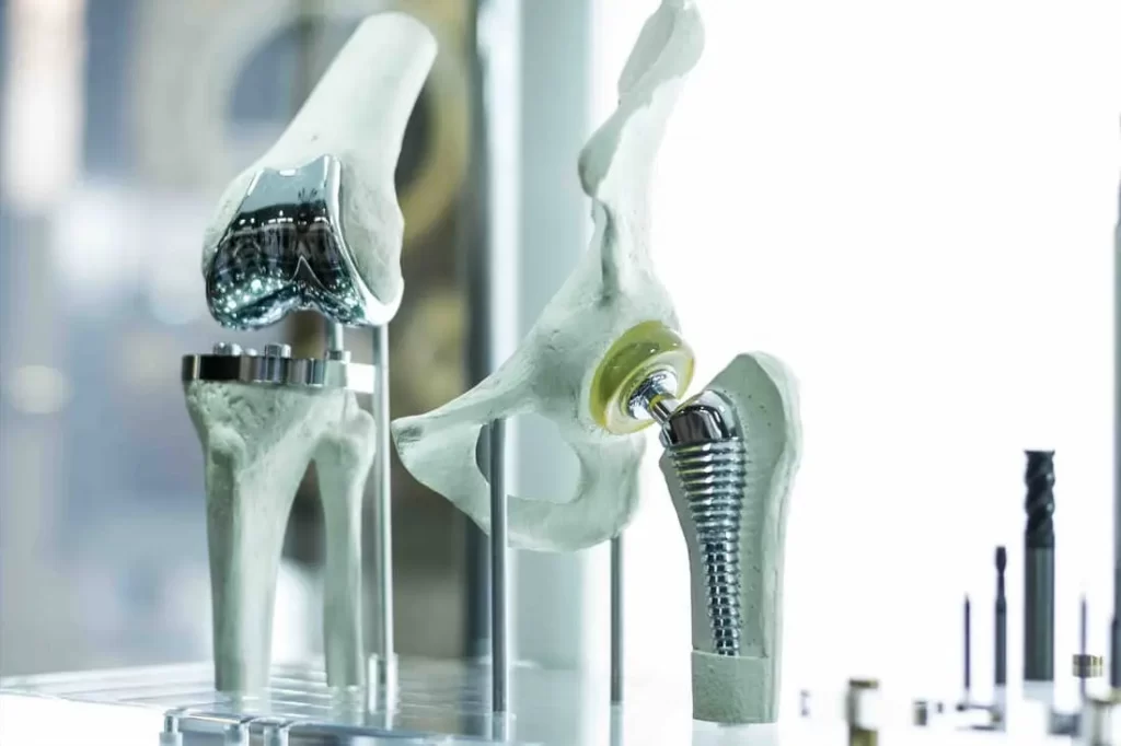 Las prótesis y el futuro de la medicina
